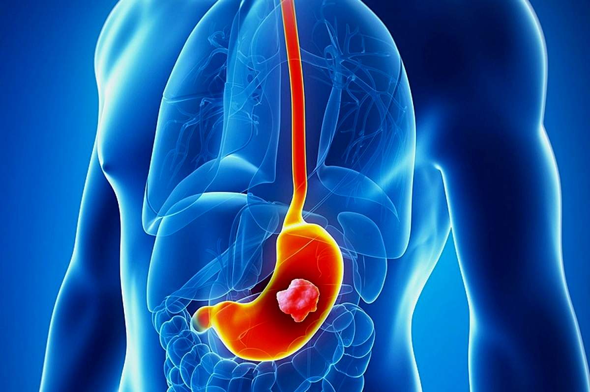 فاجعه زمستانی در کمین است: چگونه در دام نوروویروس سمی قرار نگیریم